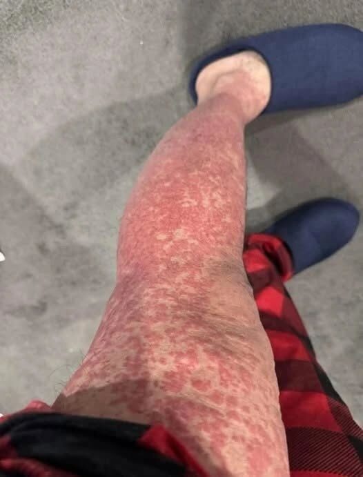 Oto konsekwencje spania z… Zobacz więcej