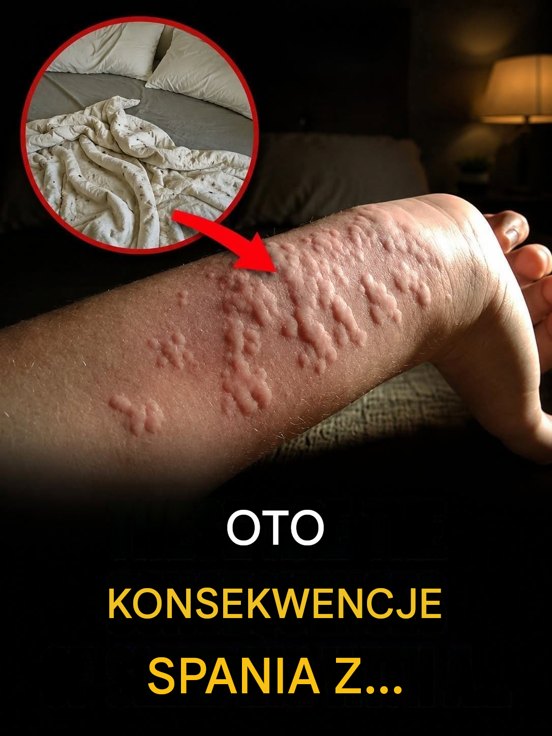 Budzisz się ze swędzącymi grudkami? Twoja pościel może ukrywać nieproszonego gościa