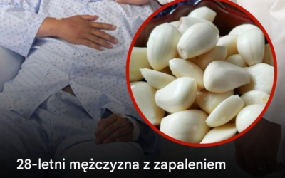 28-letni mężczyzna z zapaleniem nerek jadł czosnek codziennie przez 5 miesięcy – lekarze zaskoczeni wynikami