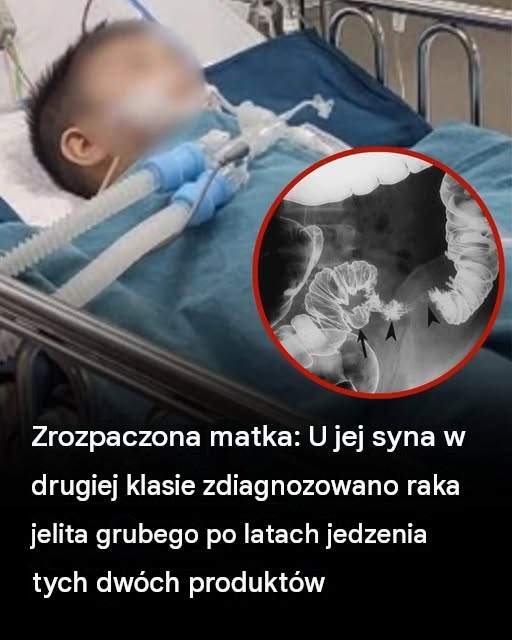 Rozpacz matki: U dziecka zdiagnozowano raka jelita grubego po latach niezdrowych nawyków żywieniowych