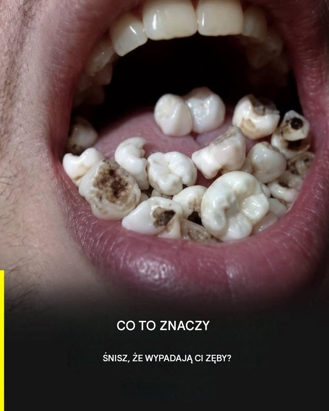 Co oznacza sen o wypadaniu zębów