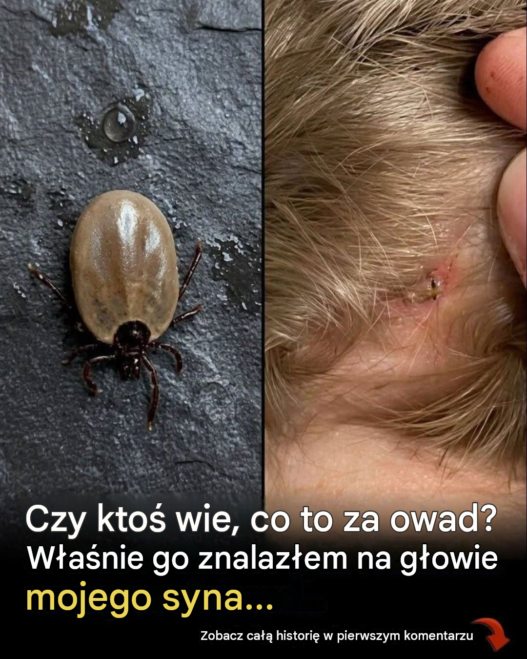 Czy ktoś wie, co to za owad? Znalazłem go we włosach mojego syna