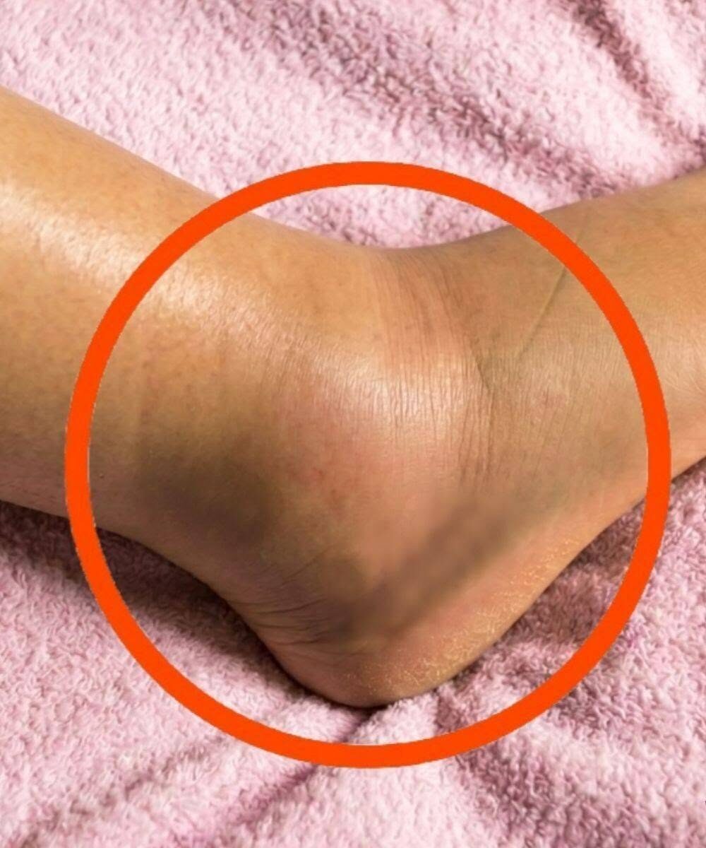 Opuchnięte nogi: co to może oznaczać? ​​Typowe przyczyny, których nigdy nie należy ignorować