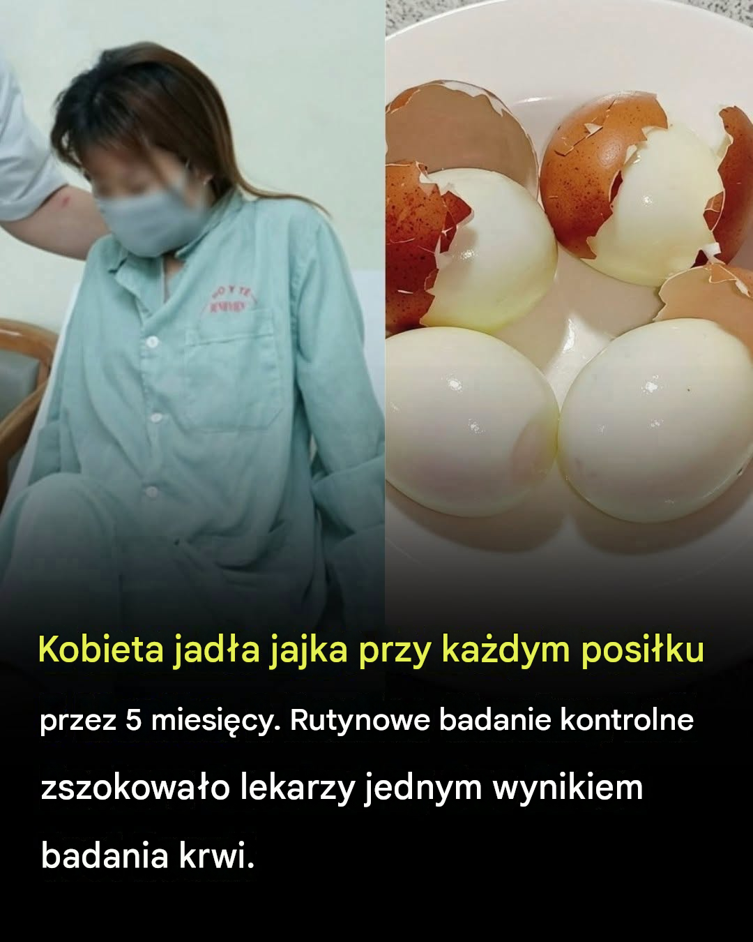 Kobieta jadła jajka na każdy posiłek przez pięć miesięcy — co odkryli lekarze podczas rutynowego badania