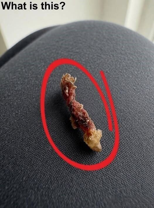 Obudziłem się z uczuciem, jakby coś waliło mnie w górną część pleców.