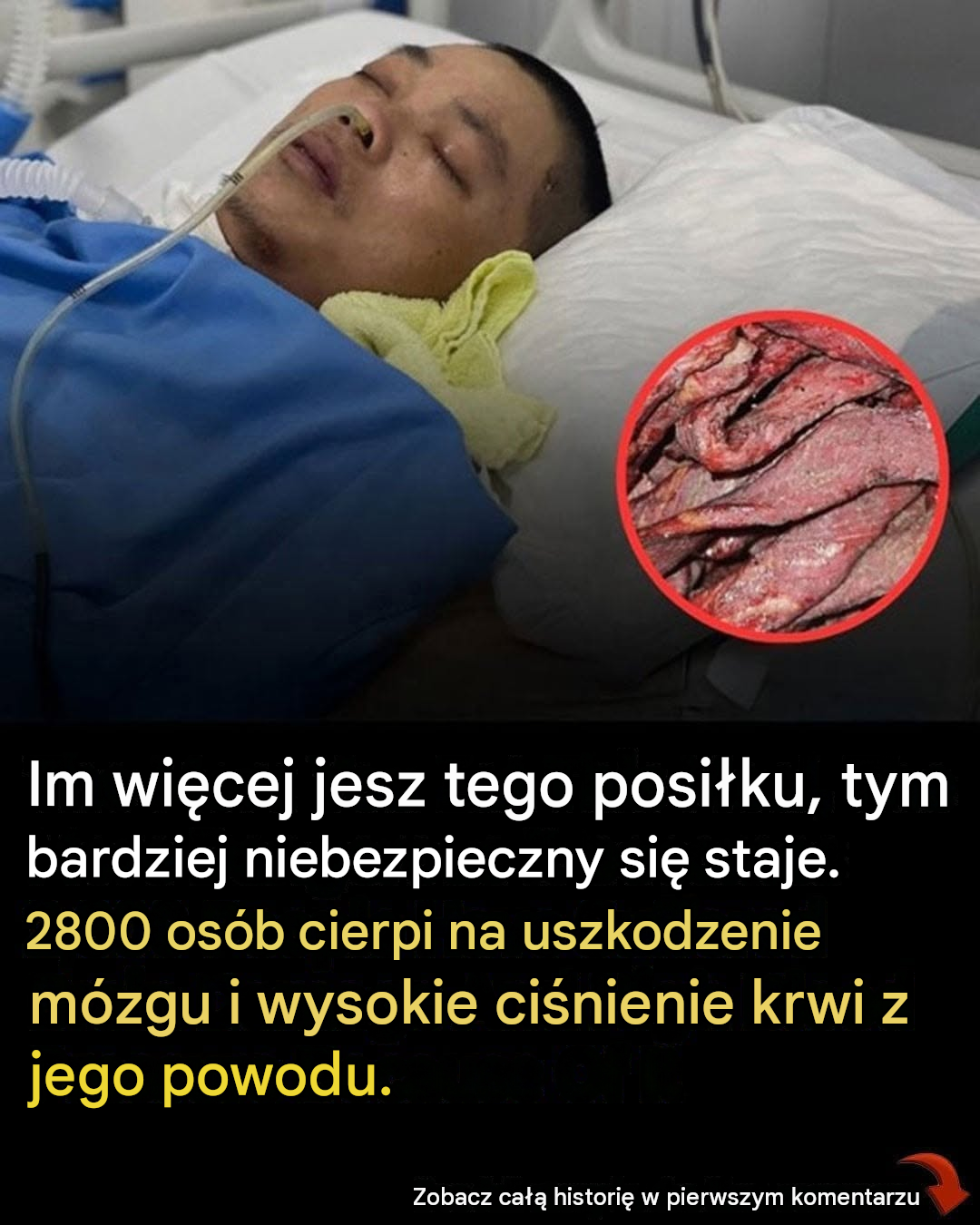 Dlaczego spożywanie większej ilości przetworzonego mięsa zwiększa ryzyko wystąpienia poważnych problemów zdrowotnych