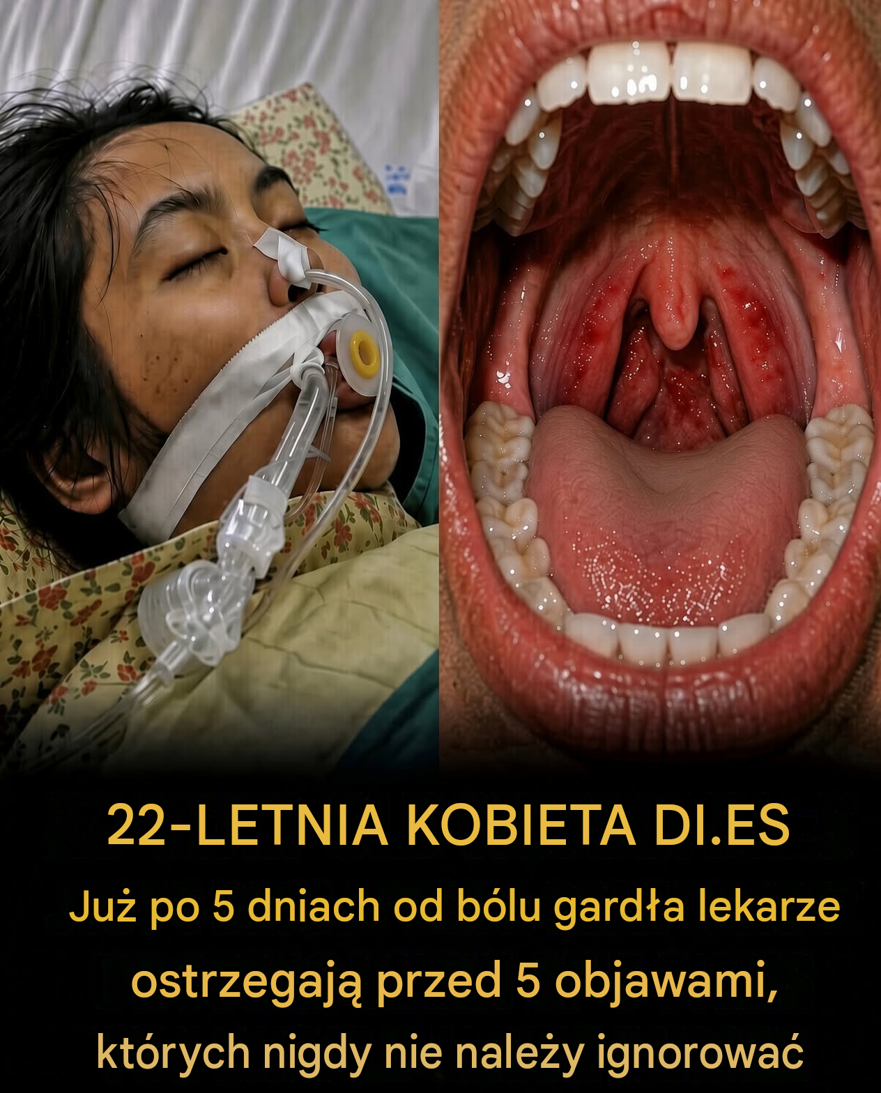 Myślała, że ​​to tylko ból gardła — pięć dni później straciła życie