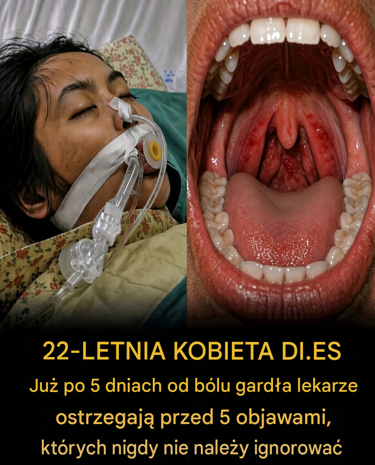 Myślała, że ​​to tylko ból gardła — pięć dni później straciła życie