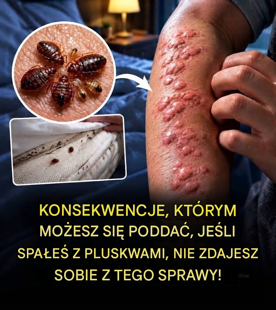 Ukryte konsekwencje spania z pluskwami ​​bez zdawania sobie z tego sprawy
