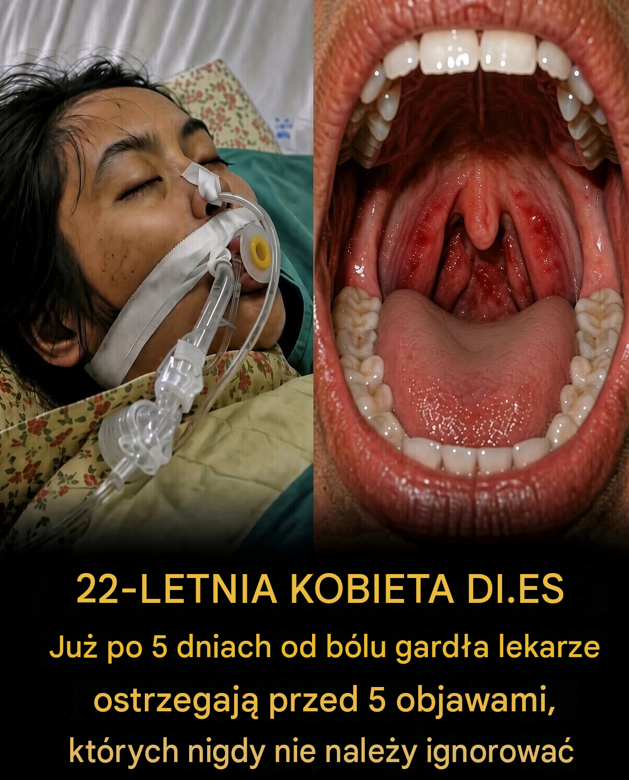 Myślała, że ​​to tylko ból gardła — pięć dni później straciła życie
