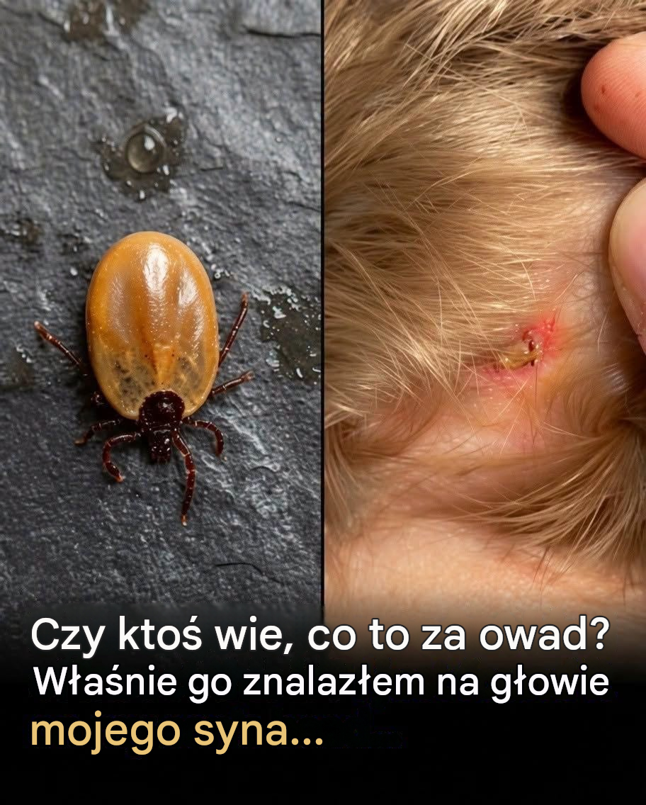 Co rodzice powinni wiedzieć o kleszczach: drobne pasożyty, na które należy zwrócić szczególną uwagę