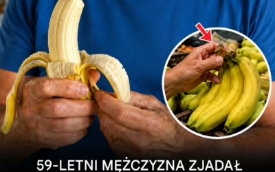 Przez rok jadł 2–3 banany każdej nocy, aż w końcu lekarze zauważyli coś nieoczekiwanego.