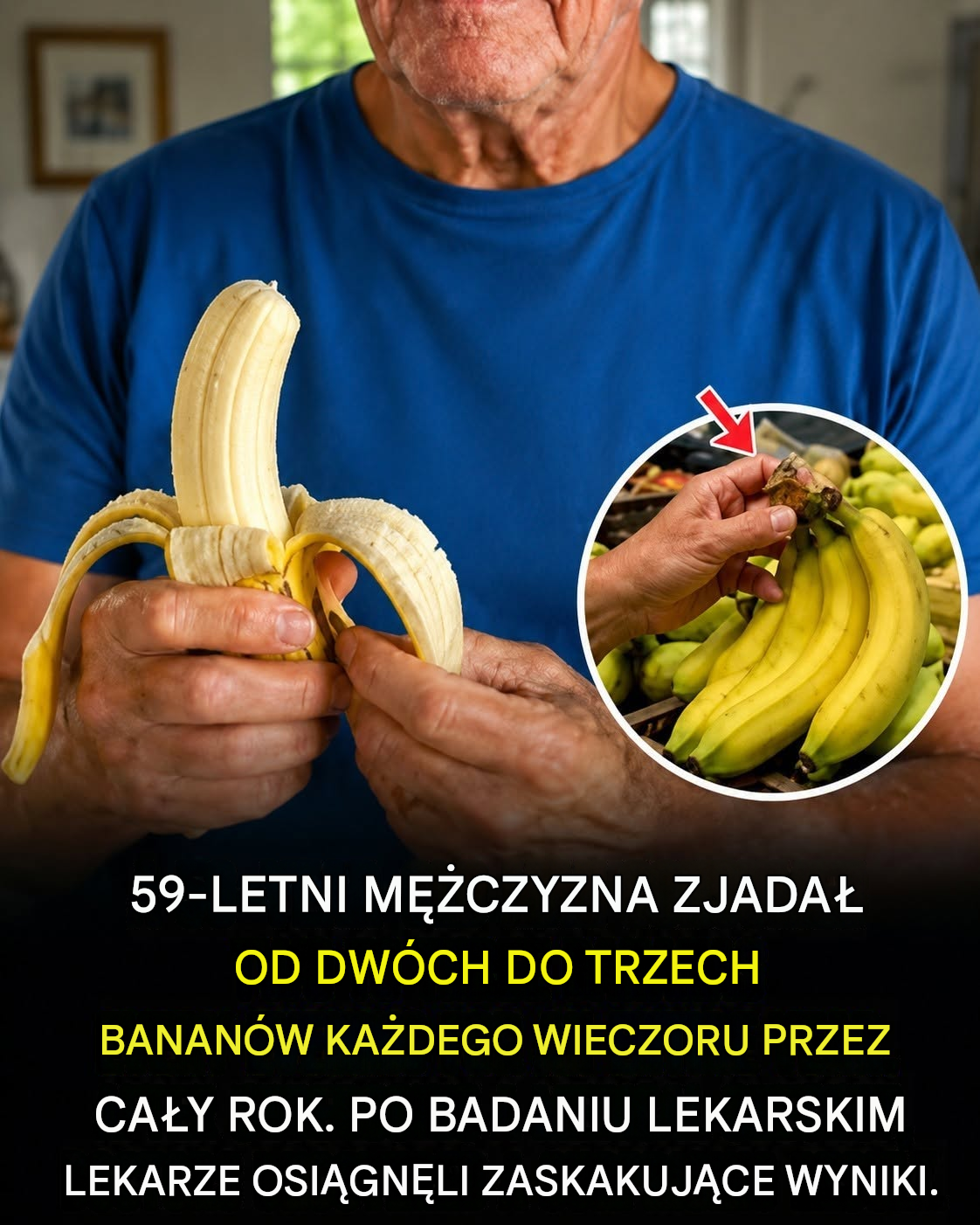 Przez rok jadł 2–3 banany każdej nocy, aż w końcu lekarze zauważyli coś nieoczekiwanego.