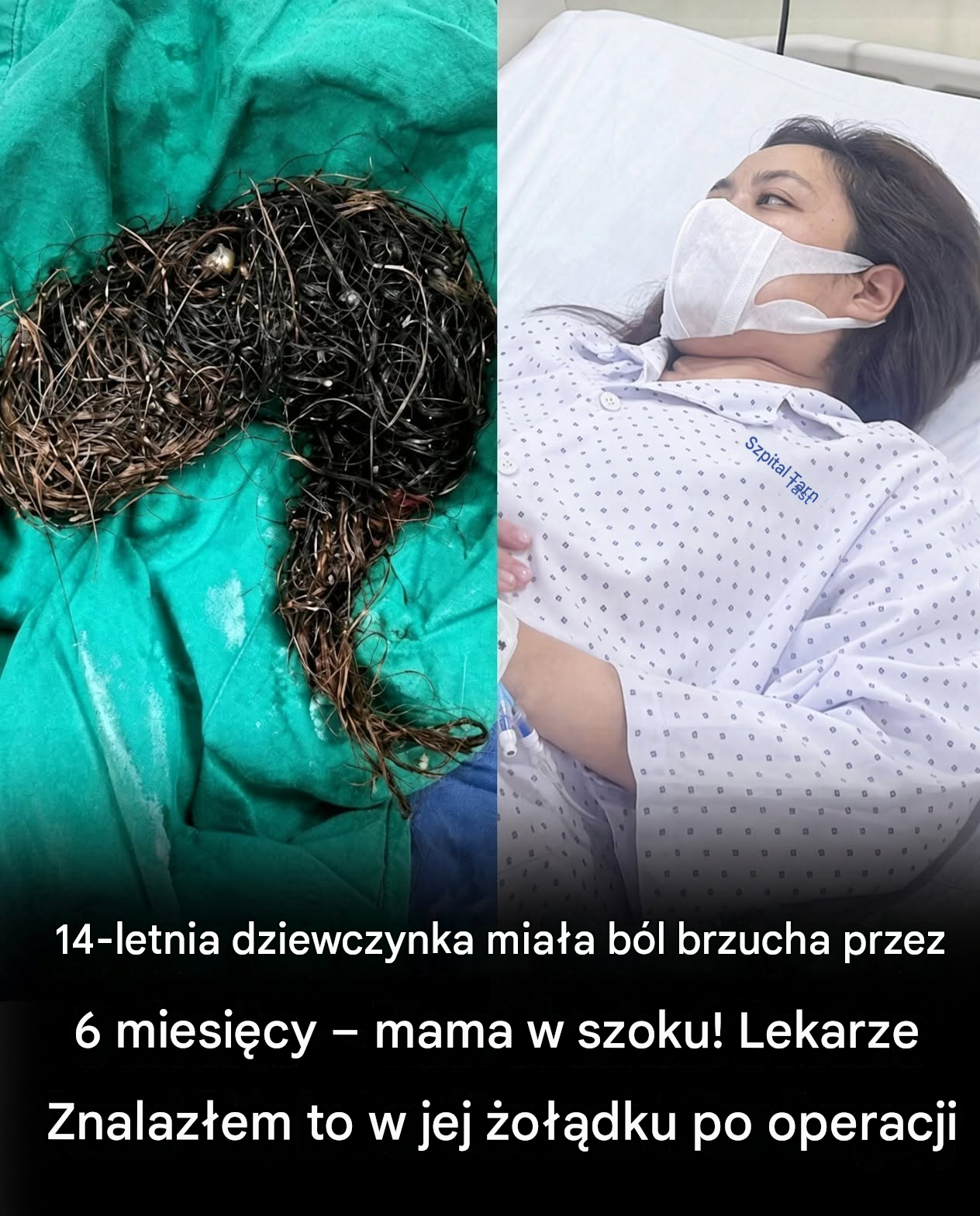14-letnia dziewczynka cierpiała na bóle brzucha przez miesiące – co odkryli lekarze