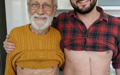 Syn, który oddał część swojej wątroby, aby uratować ojca, niestety kończy... Zobacz więcej