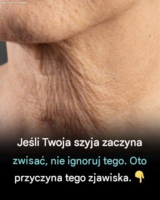 Dlaczego Twoja szyja zaczyna opadać? Poznaj przyczyny i co możesz zrobić