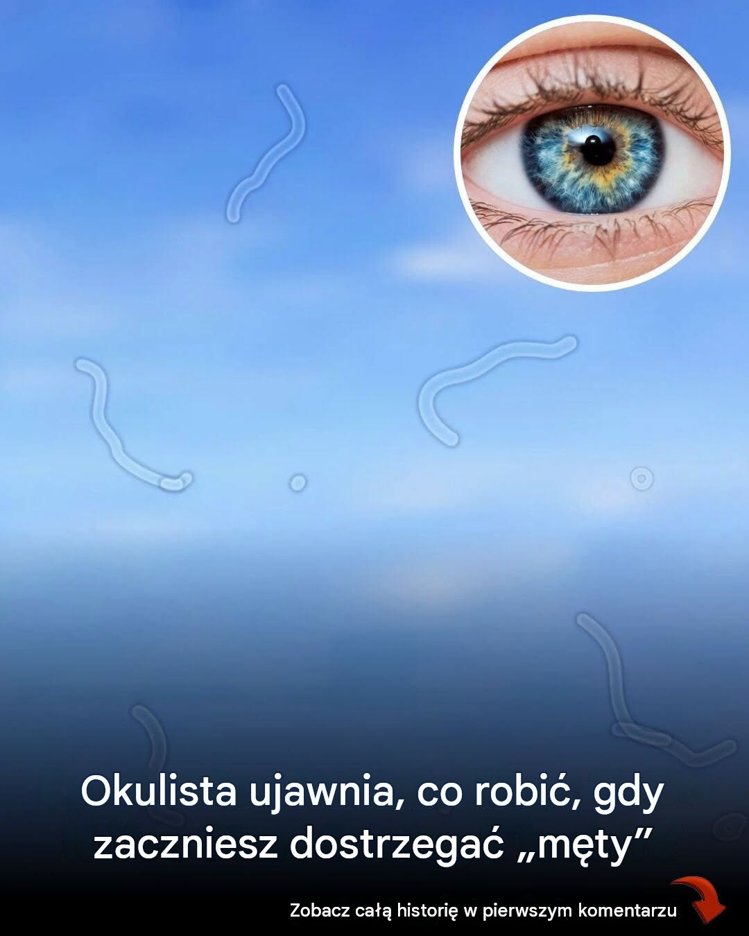 Czym są męty w oku? Oto, co zrobić, gdy zaczniesz je zauważać, według okulisty