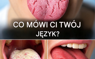 Biały język może ujawnić więcej informacji o Twoim zdrowiu, niż myślisz