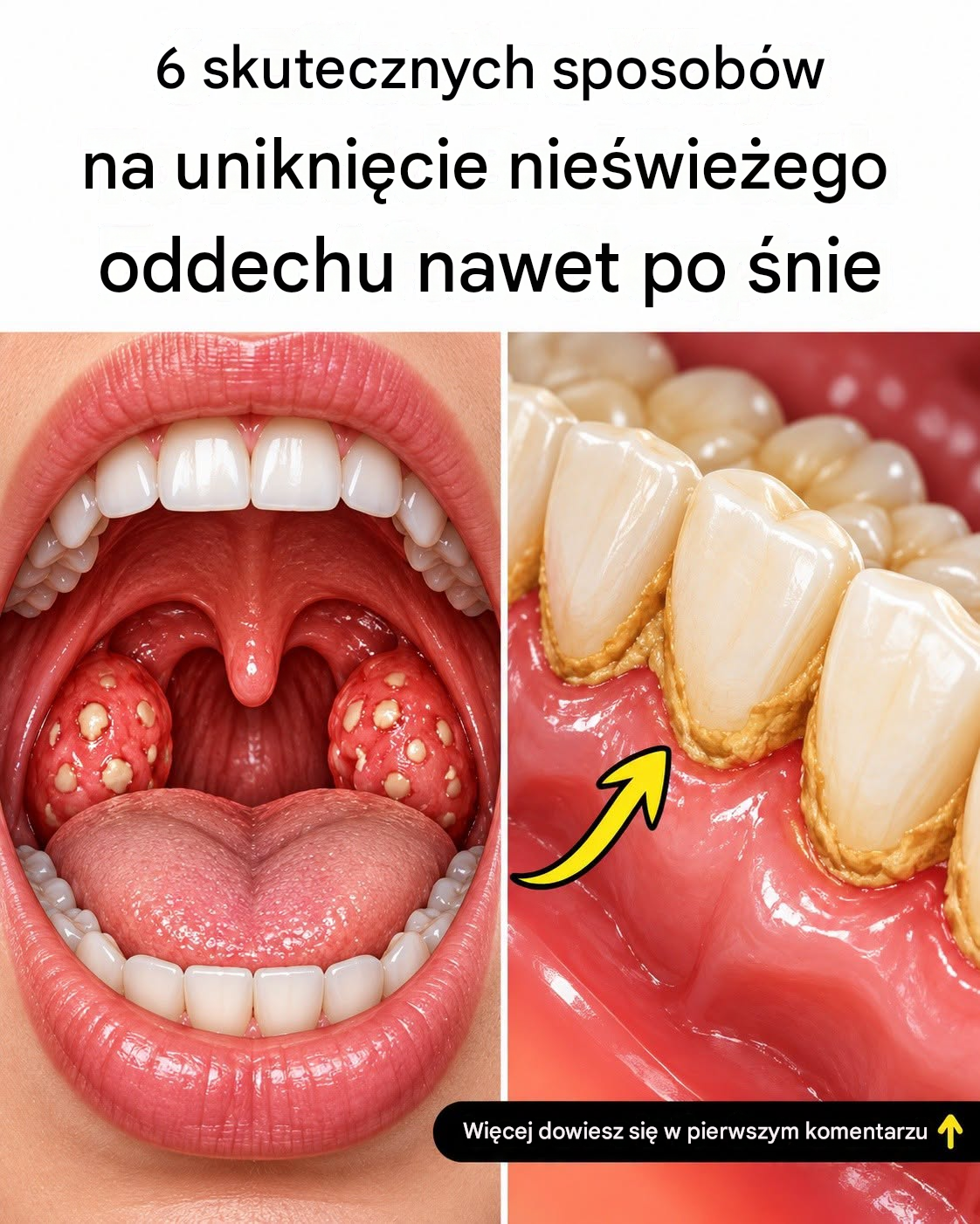 6 sprawdzonych sposobów na uniknięcie nieświeżego oddechu