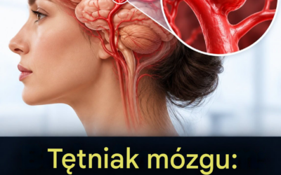 12 oznak, które mogą wskazywać na tętniaka mózgu — nie ignoruj ​​ich