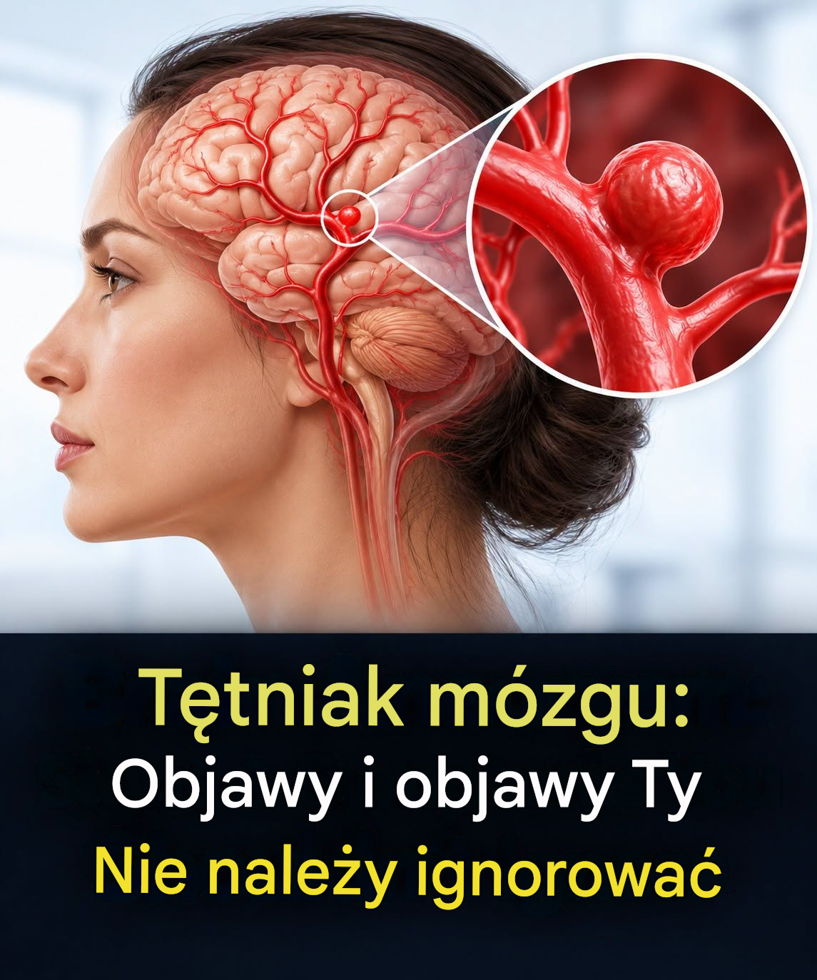 12 oznak, które mogą wskazywać na tętniaka mózgu — nie ignoruj ich