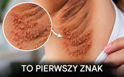 To pierwszy, wczesny objaw choroby.