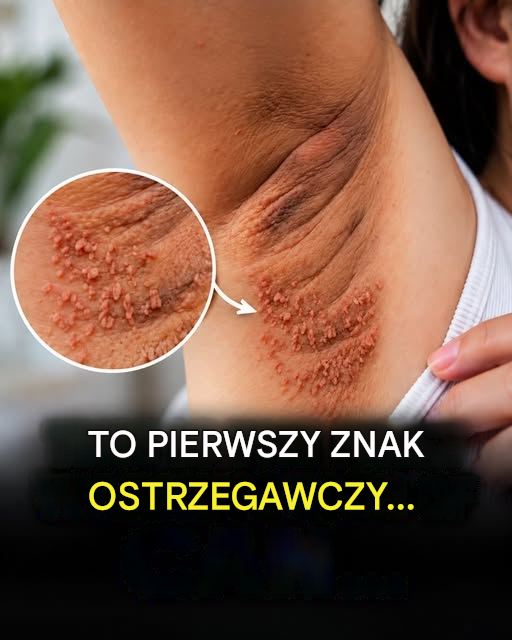 To pierwszy, wczesny objaw choroby.