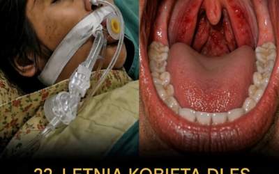 22-letnia kobieta zmarła zaledwie kilka dni po bólu gardła: sygnały ostrzegawcze, których wiele osób nie zauważa