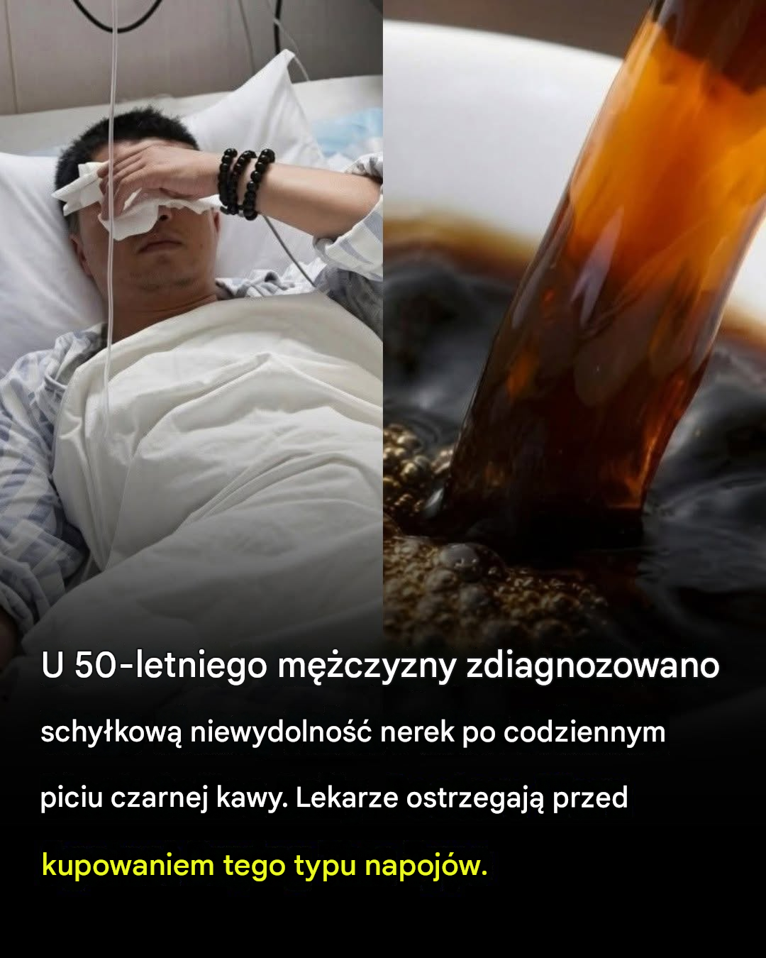 U 50-letniego mężczyzny zdiagnozowano zaawansowaną niewydolność nerek – lekarze twierdzą, że jego codzienne picie kawy to nie wszystko