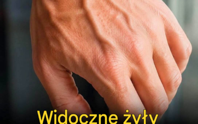 Widoczne żyły – wyjaśnienie: normalne przyczyny, zagrożenia dla zdrowia i kiedy należy się martwić