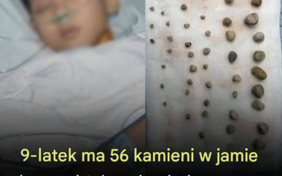 Tajemnicze kamienie 9-letniego chłopca: dlaczego codzienne nawyki dzieci mają znaczenie dla zdrowia nerek i układu moczowego